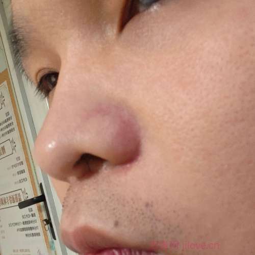 30岁岁江苏单身帅哥 - 齐齐哈尔吉缘网